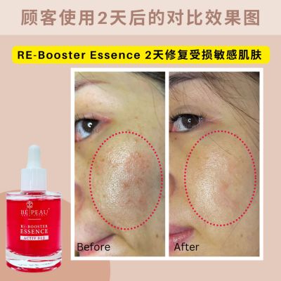Re booster essense 50ML