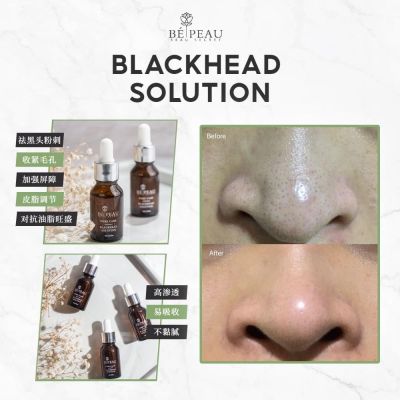 Blackhead solution